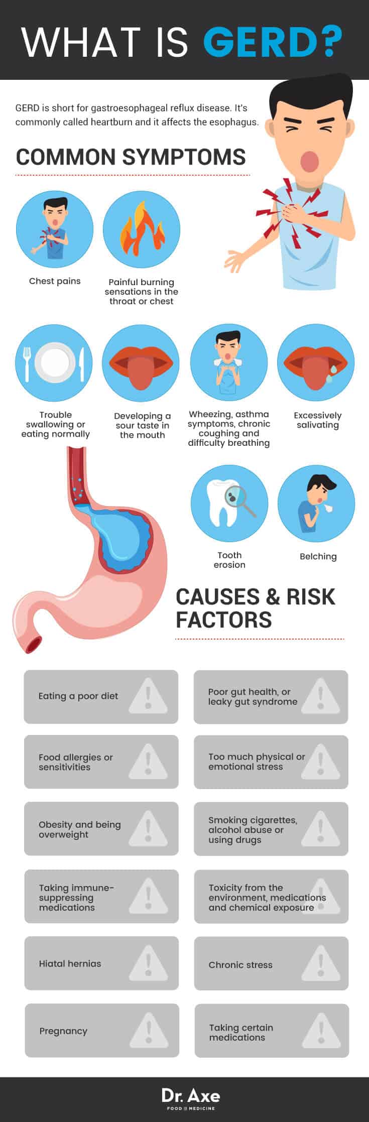 GERD causes & symptoms