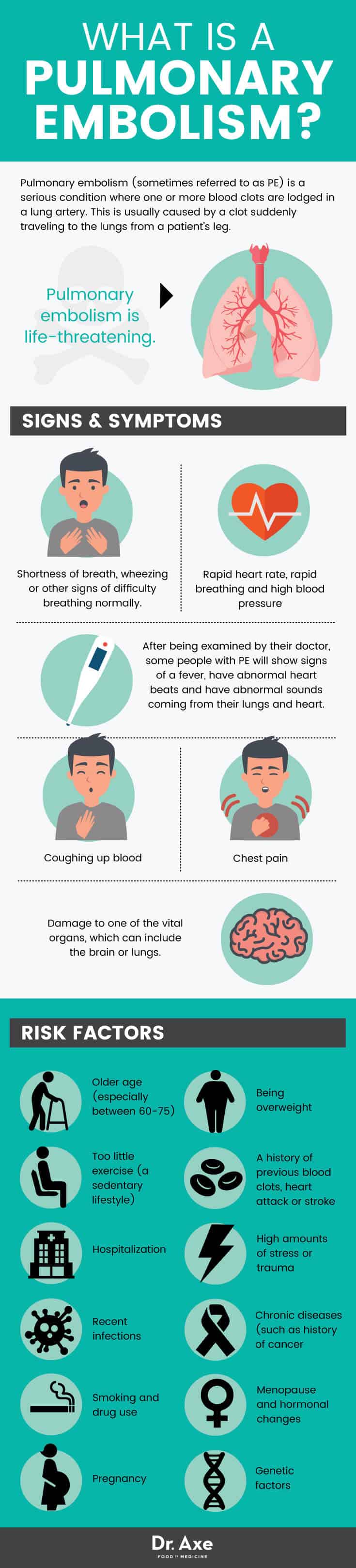 Pulmonary embolism