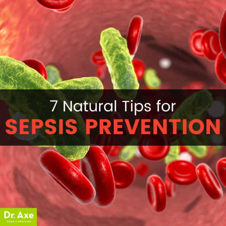 7 Natural Tips for Sepsis prevention