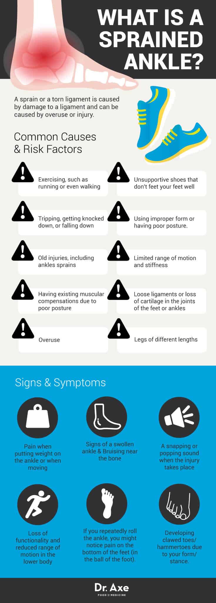 The Top Sprained Ankle Treatment  Infographic - Physio Prescription