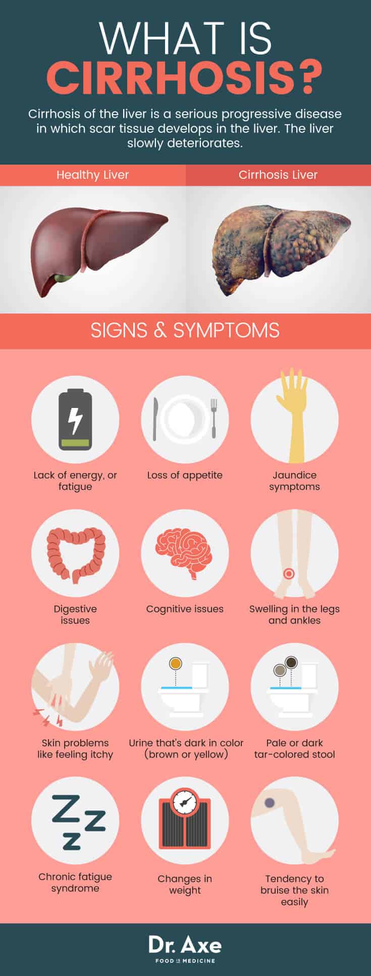 liver cirrhosis symptoms skin