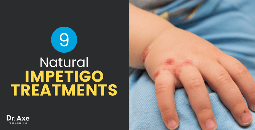 impetigo-causes-symptoms-plus-9-natural-treatments-dr-axe