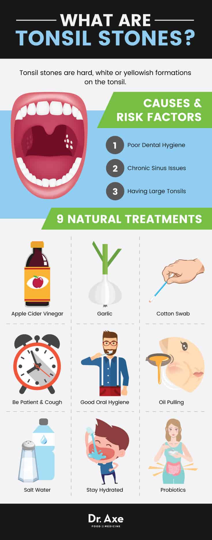 Tonsil stones natural treatments
