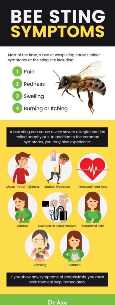 Bee Sting Treatment Natural Remedies And Diy Recipe Dr Axe