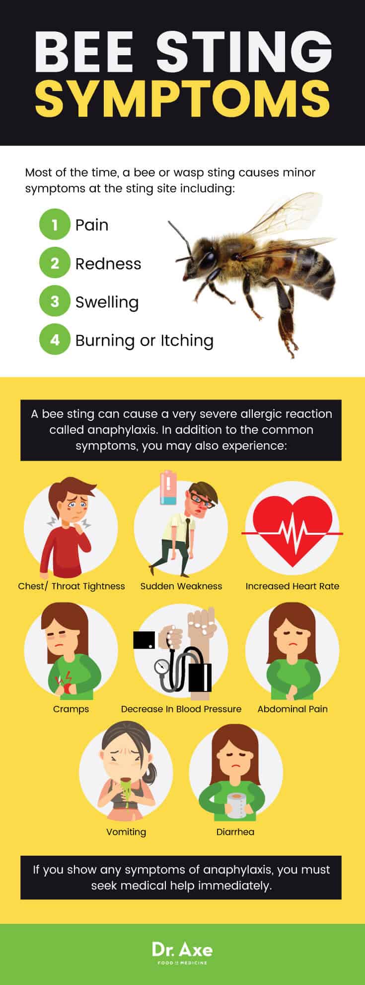 Bee sting treatment: bee sting symptoms - Dr. Axe