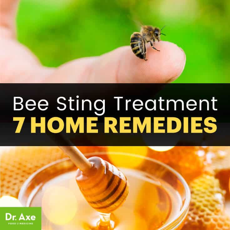 Bee sting treatment: 7 remedies - Dr. Axe