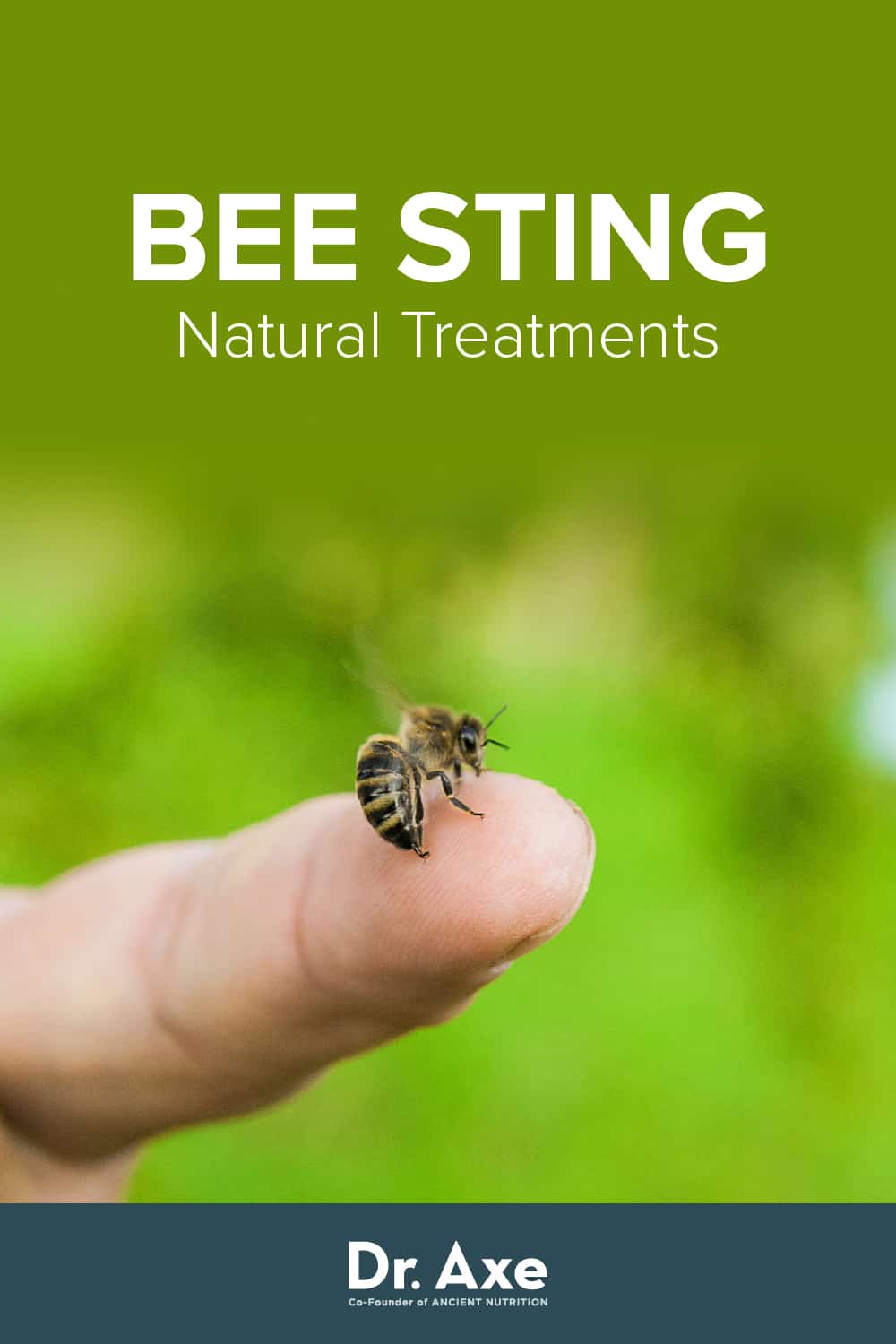 Bee Sting Treatment Natural Remedies and DIY Recipe Dr. Axe