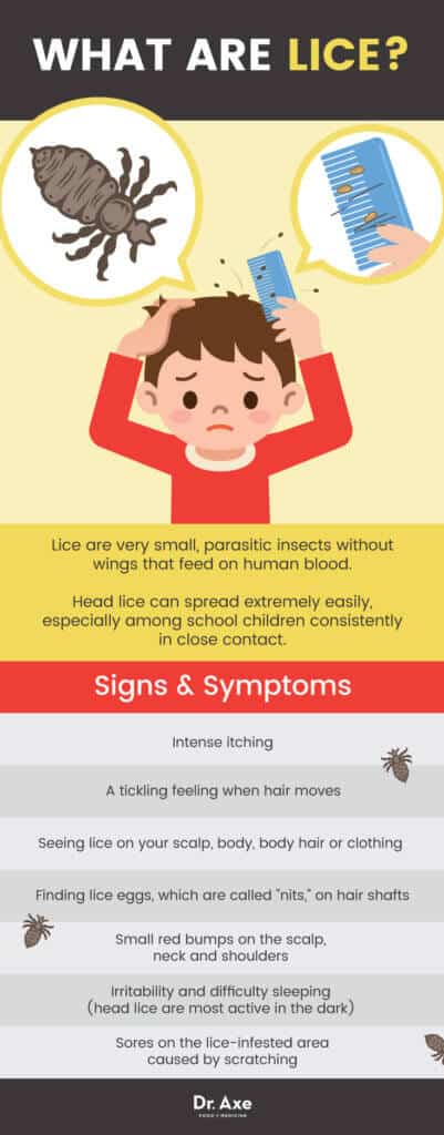 8 Remedies And Treatments To Get Rid Of Lice Dr Axe   Lice Graphic 401x1024 