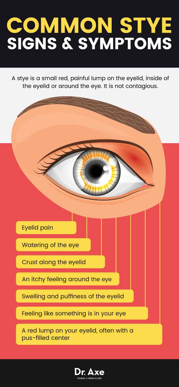 How to Get Rid of a Stye: Common Signs & Symptoms - Dr. Axe