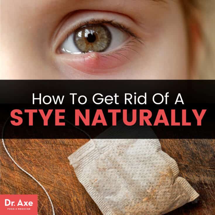 How to get rid of a stye naturally - Dr. Axe