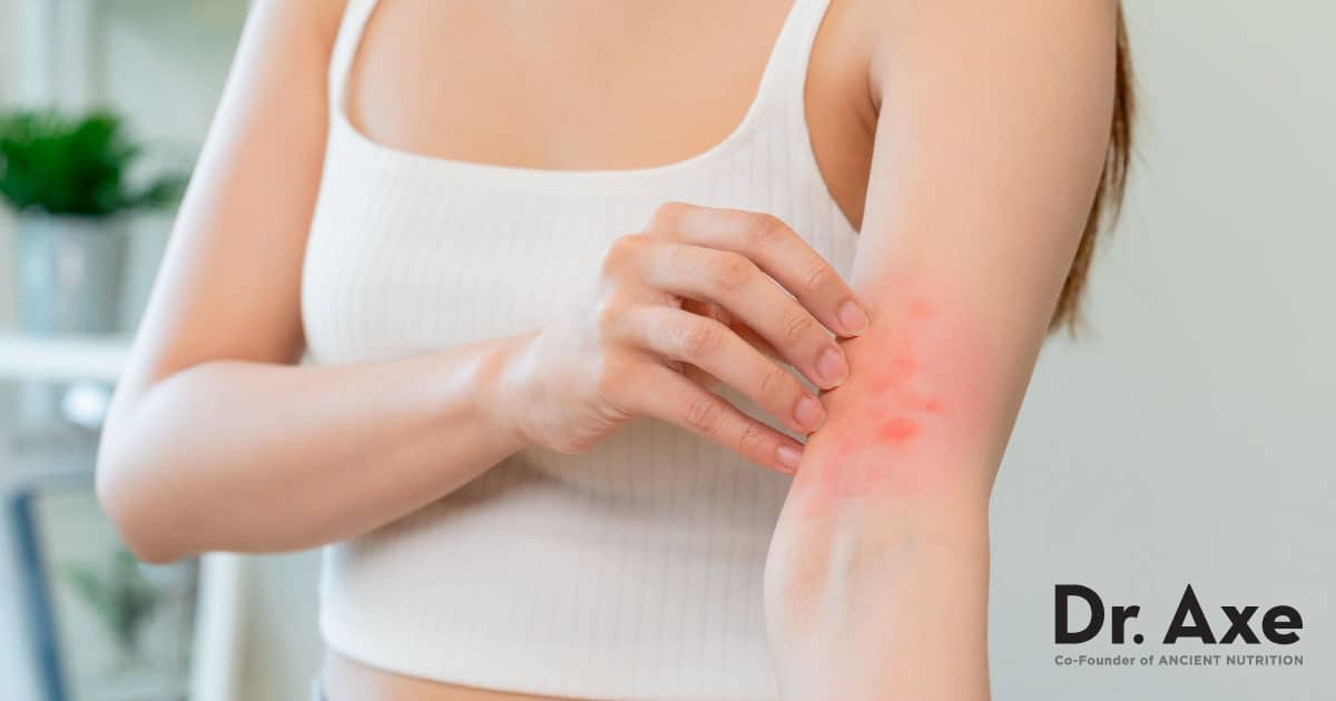 4 Common Household Products That Might Be Causing Your Eczema