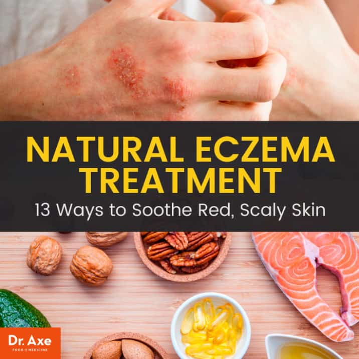 How To Treat Eczema On Inner Thighs