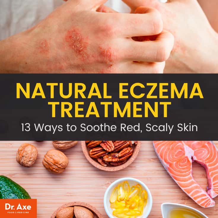 Natural eczema treatment - Dr. Axe