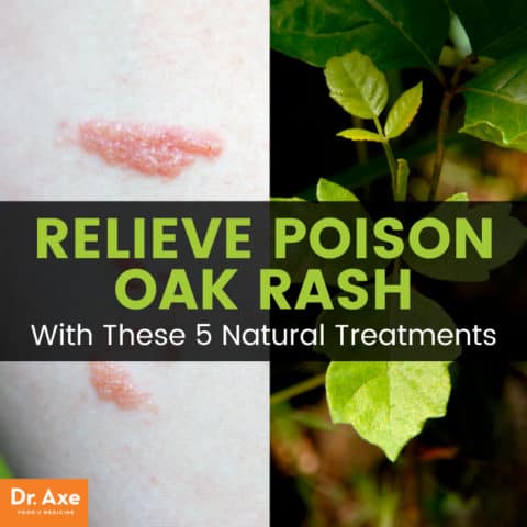 Poison Oak Rash Symptoms + 5 Soothing Natural Treatments - Dr. Axe