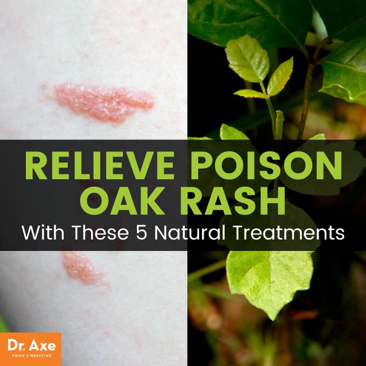 Relieve poison oak rash - Dr. Axe