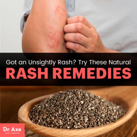 How To Get Rid Of A Rash: 6 Natural Rash Remedies - Dr. Axe