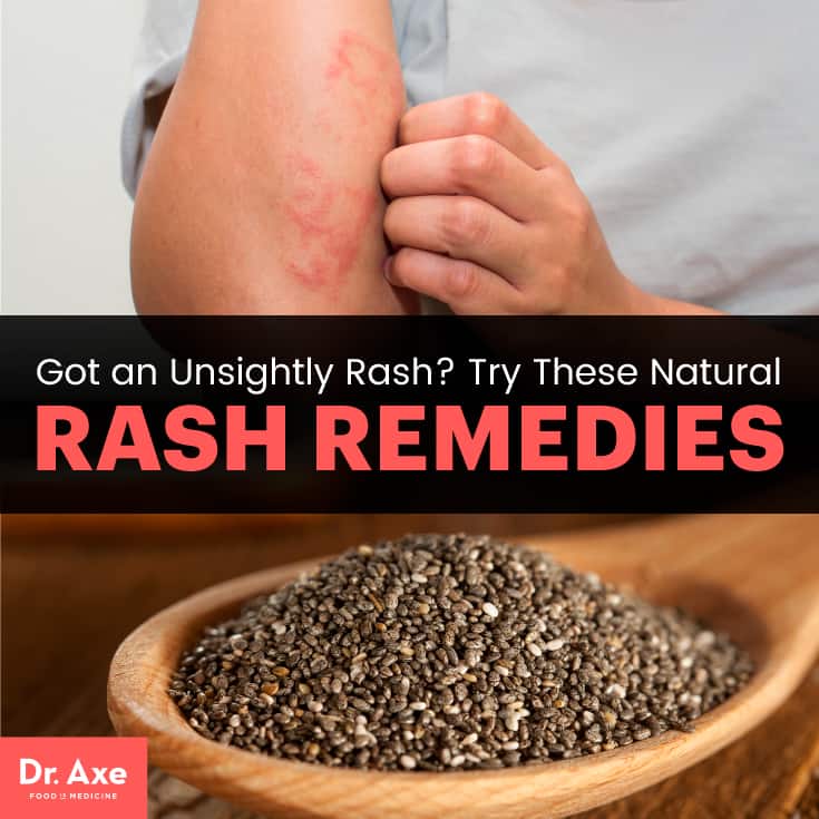 How to get rid of a rash: natural remedies for rashes - Dr. Axe