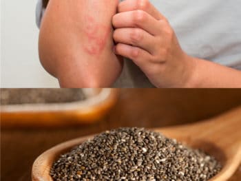 How to ret rid of a rash: natural rash remedies - Dr. Axe
