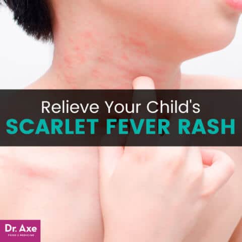 Scarlet Fever Rash Relief: 10 Soothing Natural Treatments - Dr. Axe