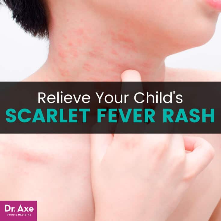 Relieve Your Child's Scarlet Fever Rash - Dr. Axe
