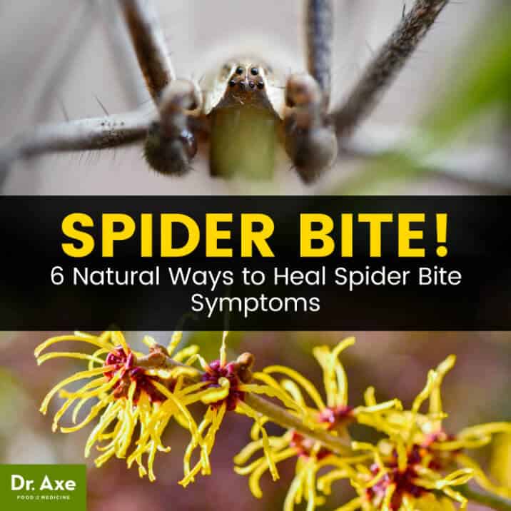 Spider Bite Symptoms + How & When To Treat Them At Home - Dr. Axe