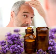 Alopecia areata - Dr. Axe