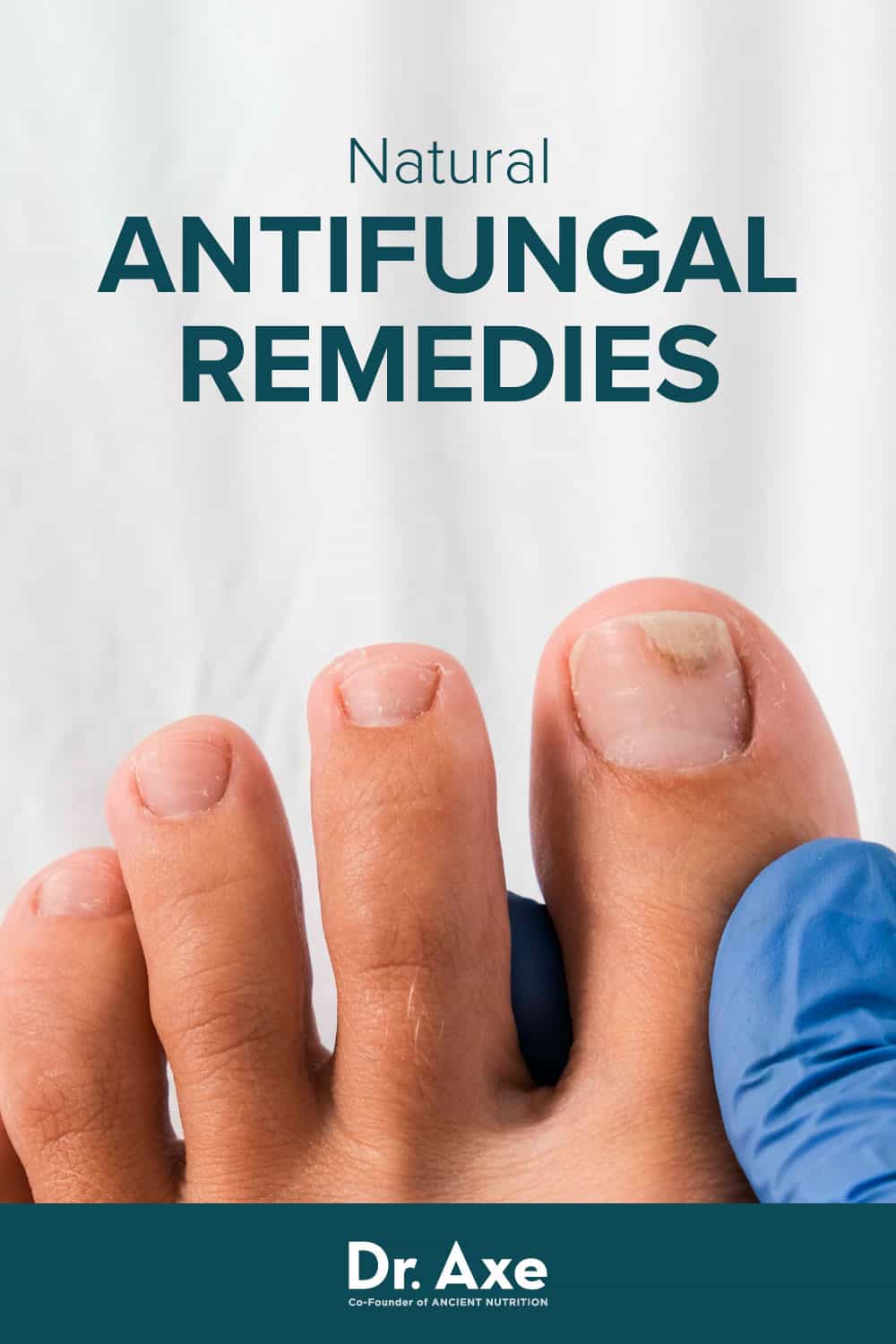 Homemade Antifungal Cream Plus Natural Remedies Dr. Axe