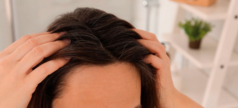 How to stop hair loss