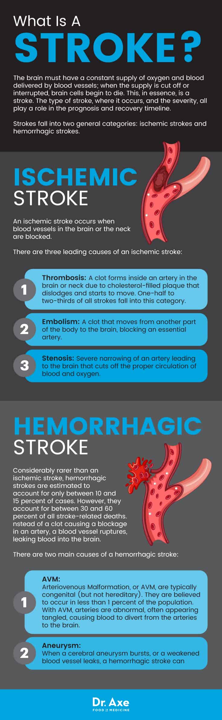 What is a stroke?: warning signs of a stroke - Dr. Axe