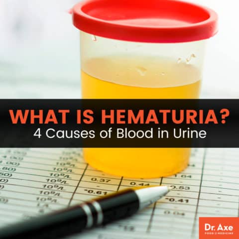 Hematuria: Causes of Blood in Urine + 4 Natural Approaches - Dr. Axe