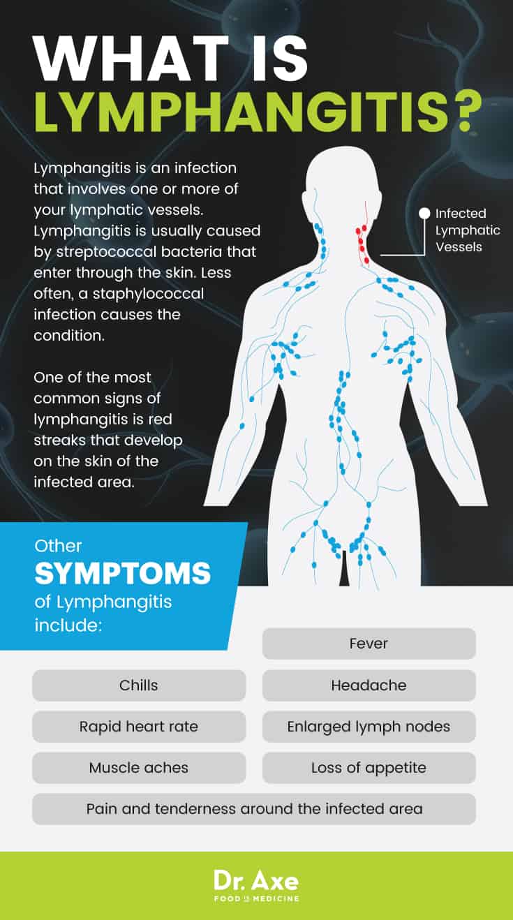 What is lymphangitis? - Dr. Axe