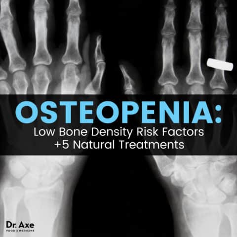 Osteopenia Risk Factors + 5 Natural Treatments - Dr. Axe