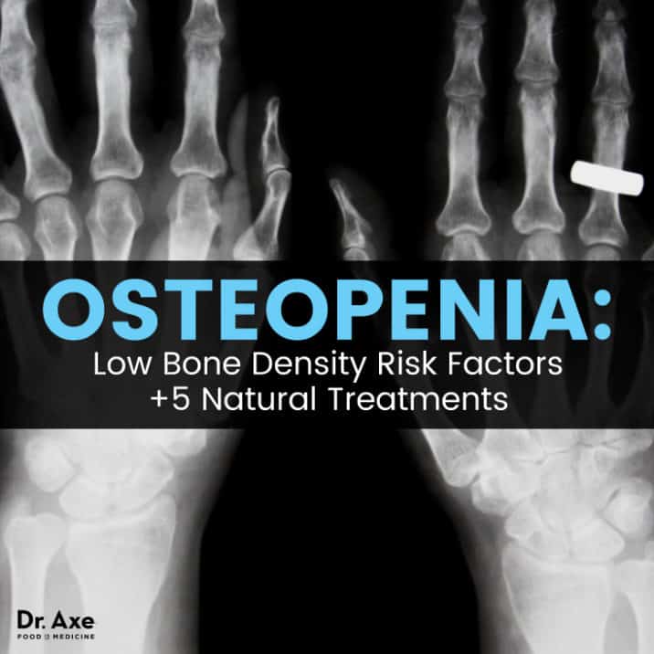 Osteopenia Risk Factors 5 Natural Treatments Dr Axe