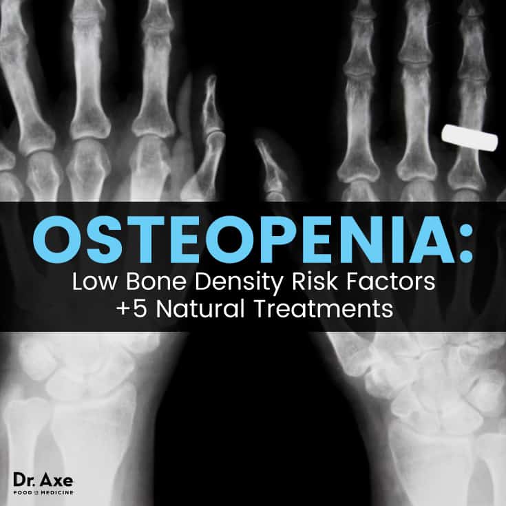 Osteopenia + 5 natural treatments - Dr. Axe