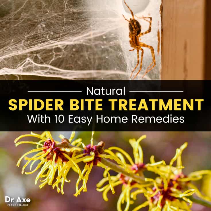 Natural spider bite treatment - Dr. Axe