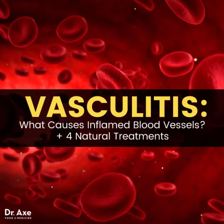 Vasculitis Natural Treatments For Inflamed Blood Vessels Dr Axe