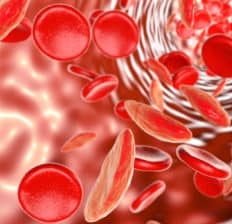 Sickle cell anemia - Dr. Axe