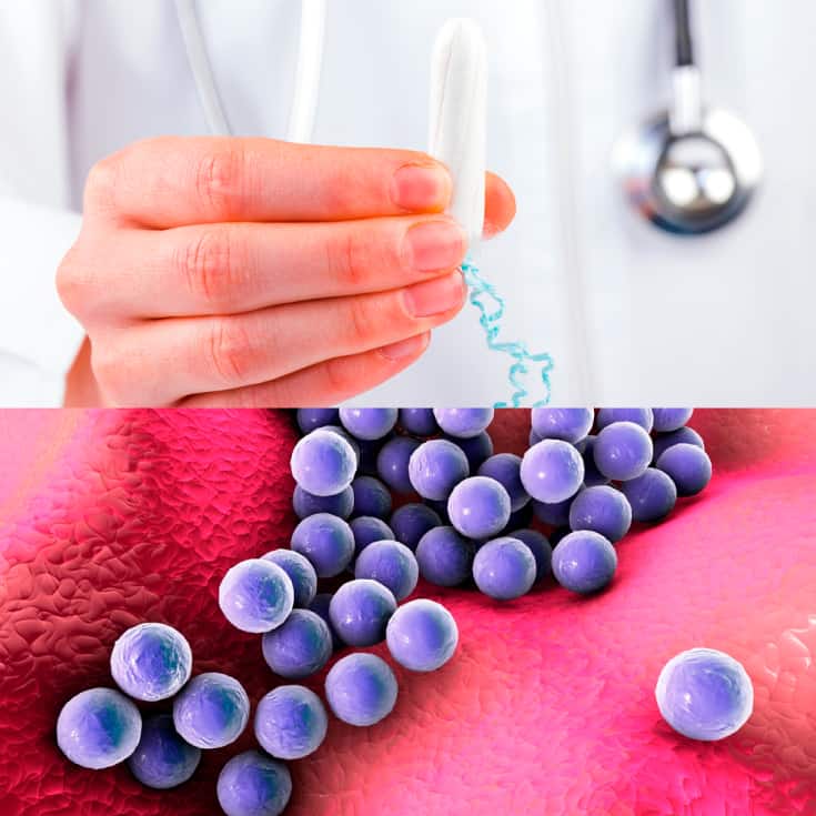 Toxic shock syndrome symptoms - Dr. Axe