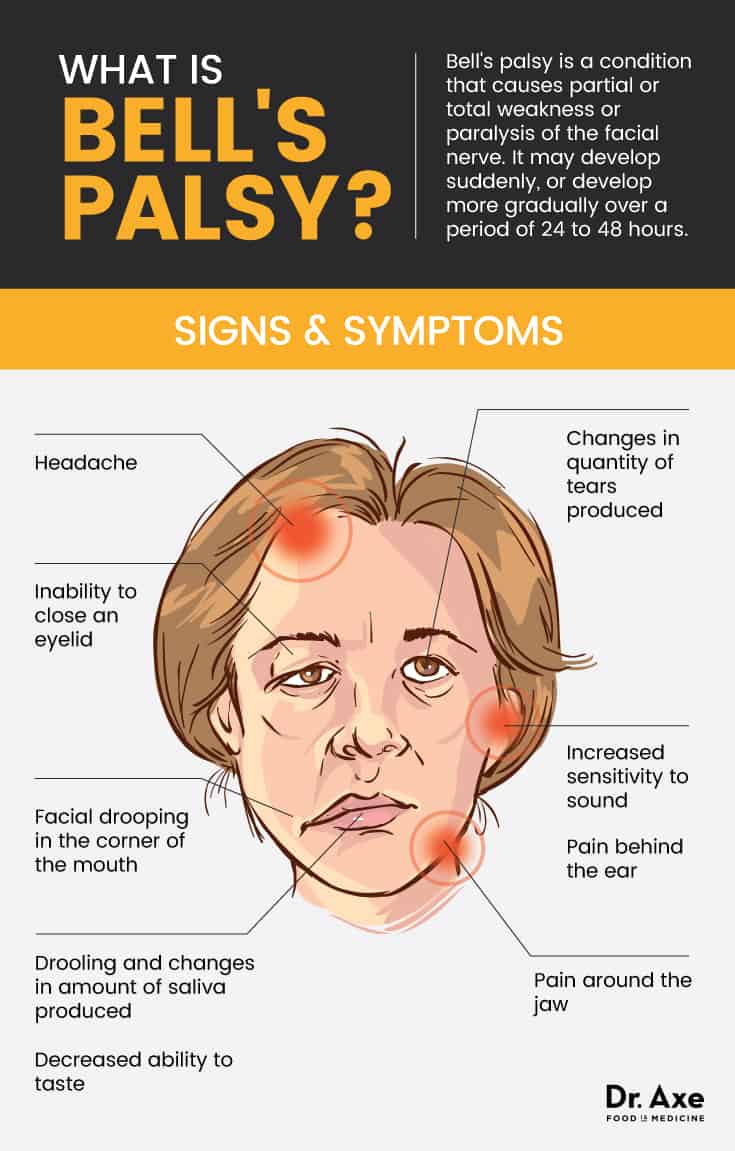 Bell's palsy signs and symptoms - Dr. Axe