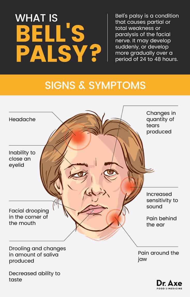 Drooping Face: How to Treat Bell's Palsy with Physiotherapy - pt