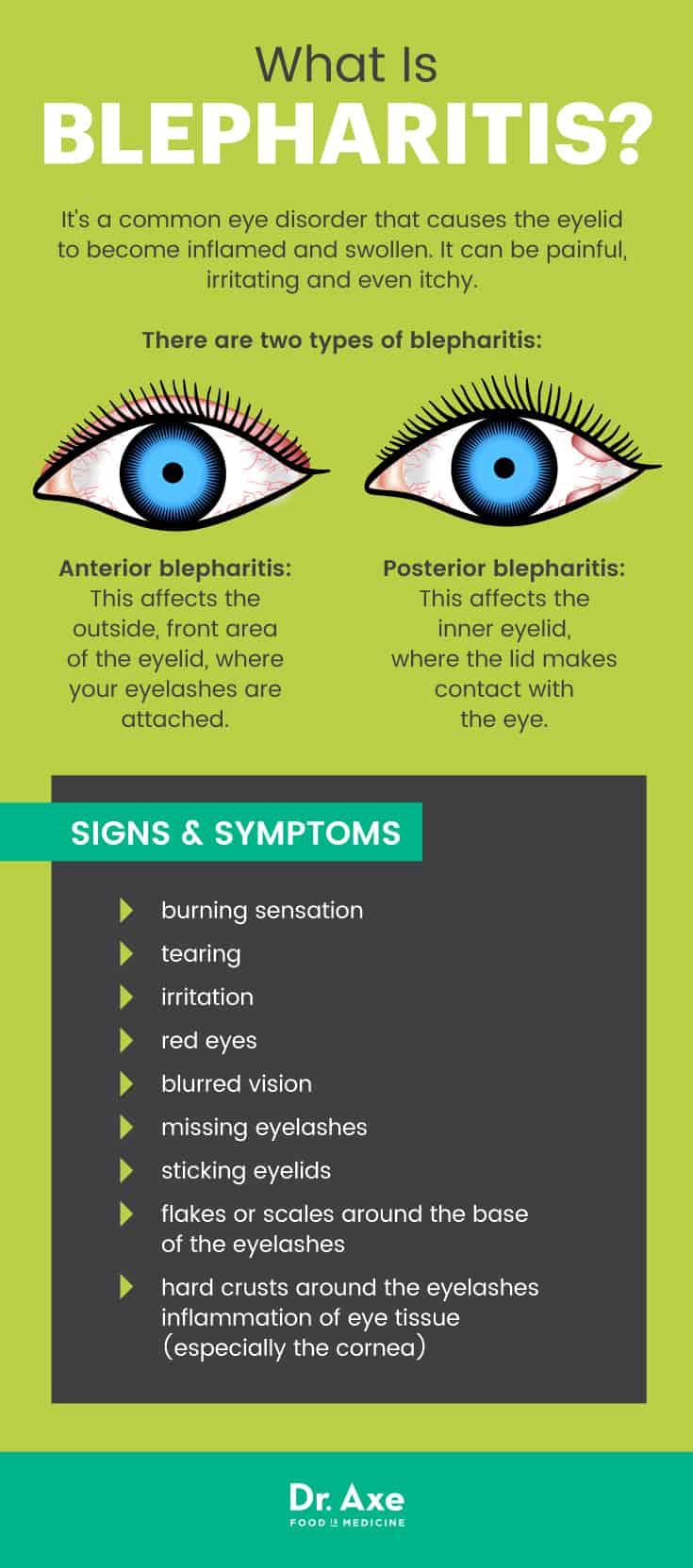 Swollen eyelid deals infection