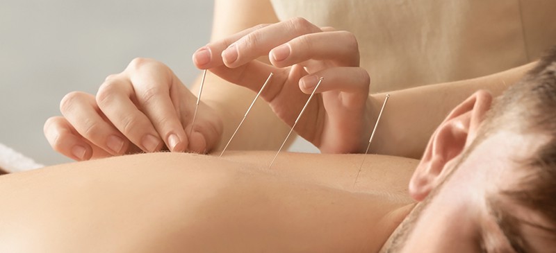 Acupunture: Benefits, How It Works, Side Effects - Dr. Axe