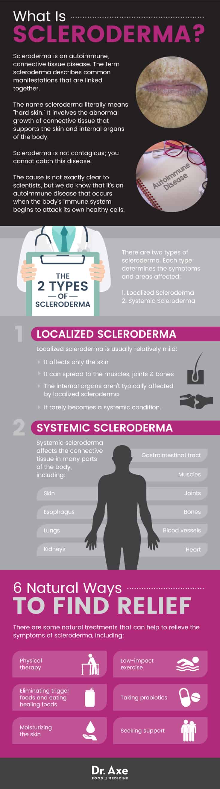 What is scleroderma? - Dr. Axe