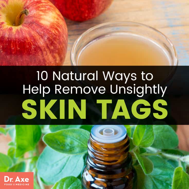 How to Remove Skin Tags 10 Natural (& Safe) Ways Dr. Axe