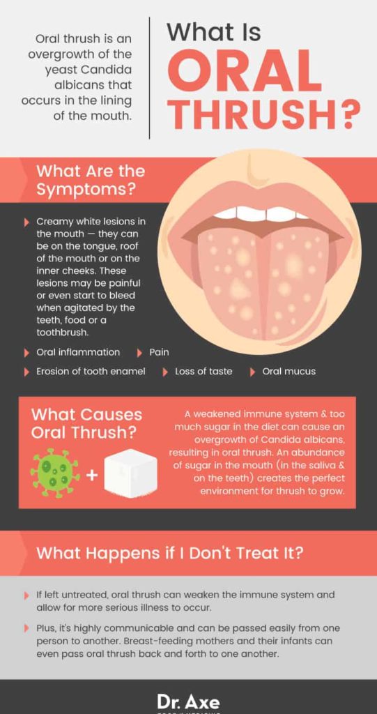 Oral Thrush Symptoms, Causes, Treatment, Prevention Dr. Axe