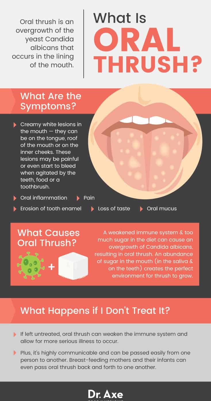 What is oral thrush? - Dr. Axe