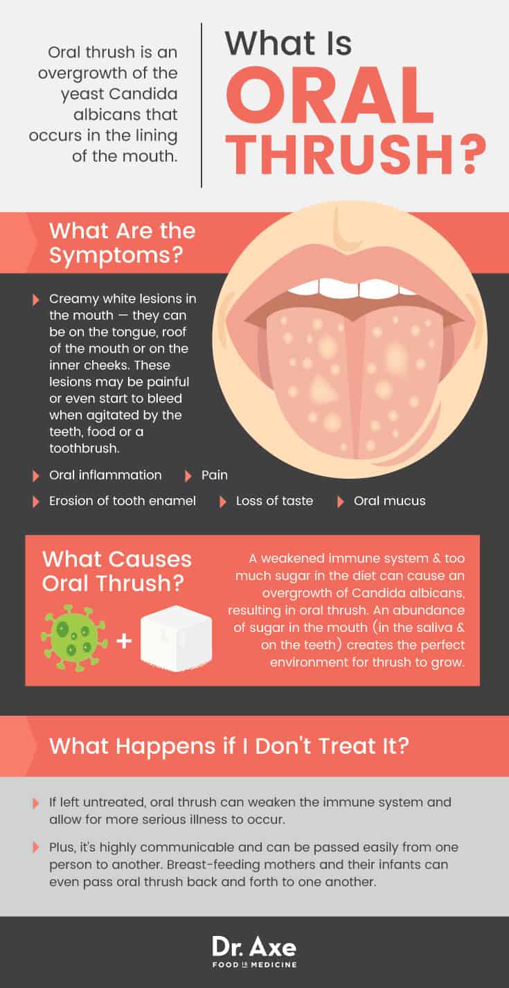 What is oral thrush? - Dr. Axe
