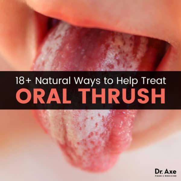 Oral Thrush And 18 Natural Treatments To Relieve It Dr Axe 8668