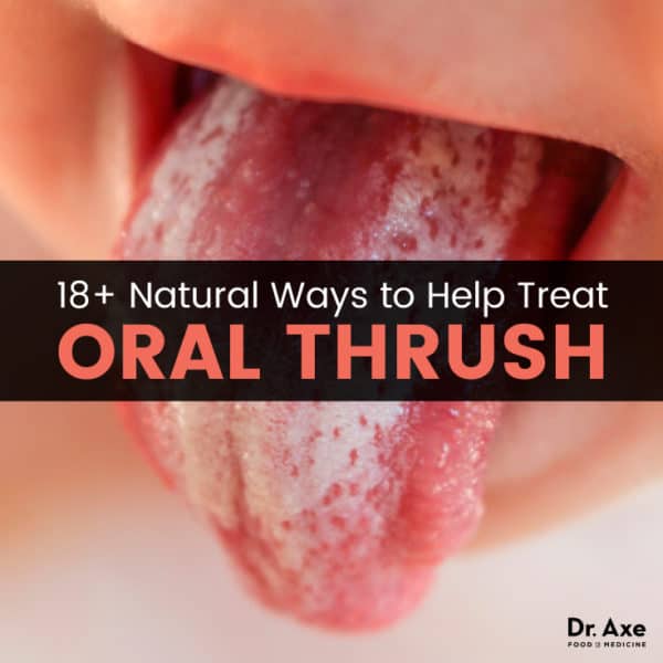 Oral Thrush 18 Natural Treatments To Relieve It Dr Axe