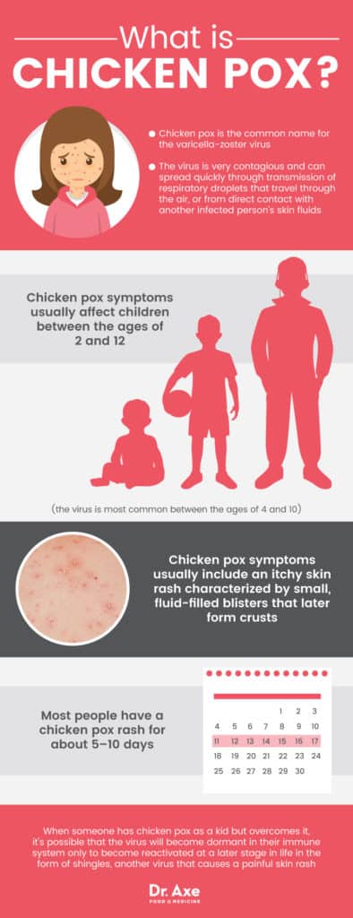 Chicken Pox Symptoms + How to Find Natural Relief - Dr. Axe